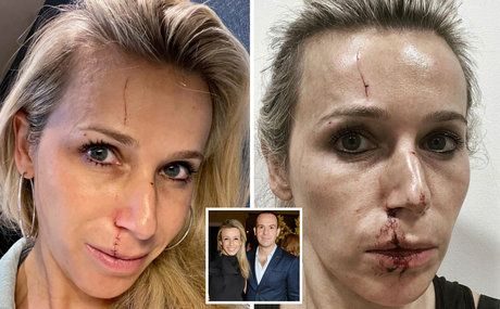 Lara Lewington model nude pic