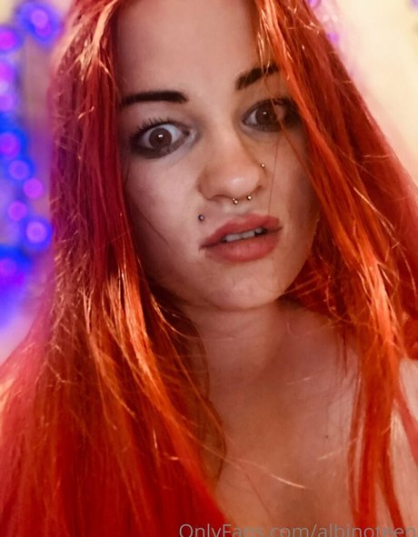 albinoteen star high quality pic