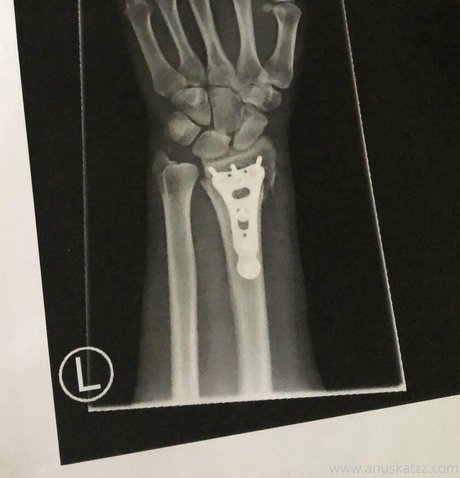 Anuskatzz pornstar free galleries