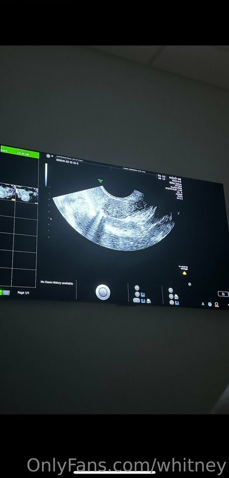 teen ladyboy onlyfans sexy naked img