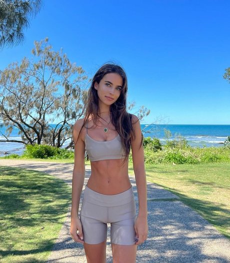 Herbert Twins high quality star galleries