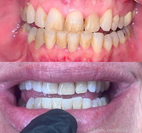 vegan onlyfans sex gallery