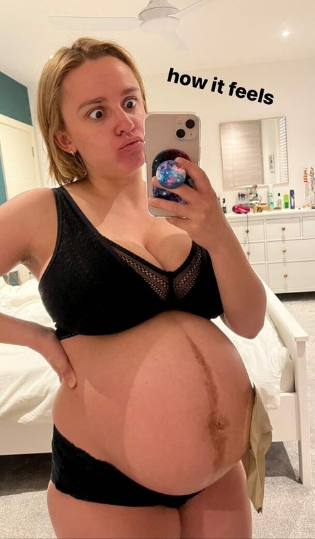 Hannah Witton erotic actress gallery