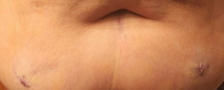 blemishedbeauty hot pornstar gallery