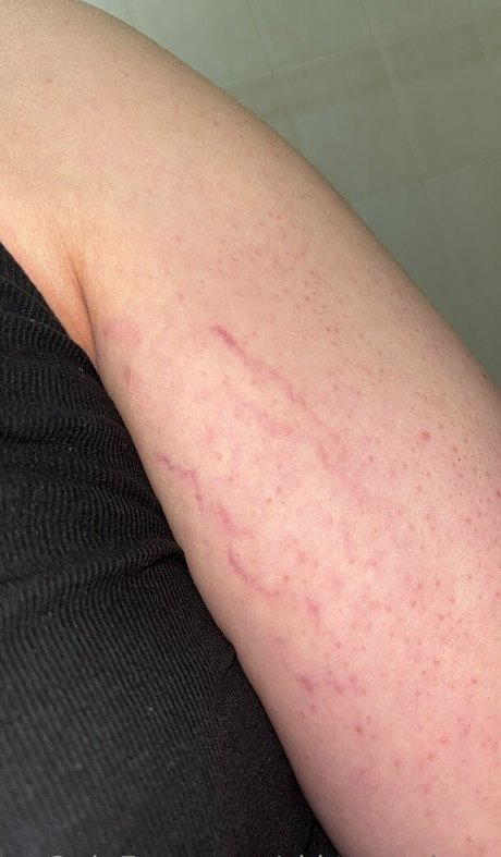 skinny twiggy model free img