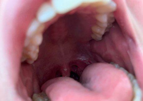 aliceeats high quality model picture