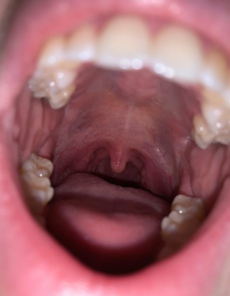 aliceeats high quality model image