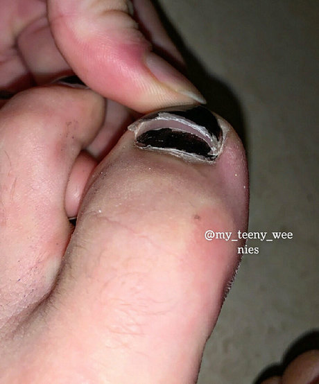 my teeny weenies best model gallery