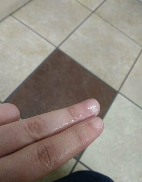 katmatata xxx star pictures