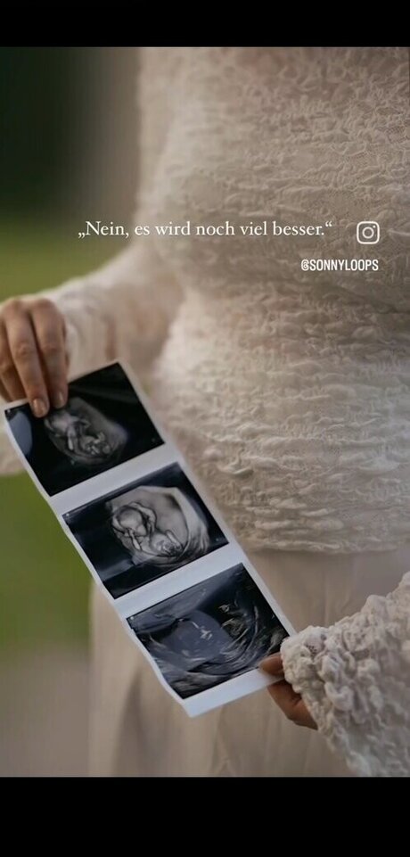 Sonny Loops freie pornographische foto