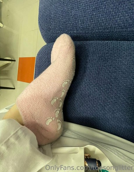 toesonglitter kunst nacktheit galerie