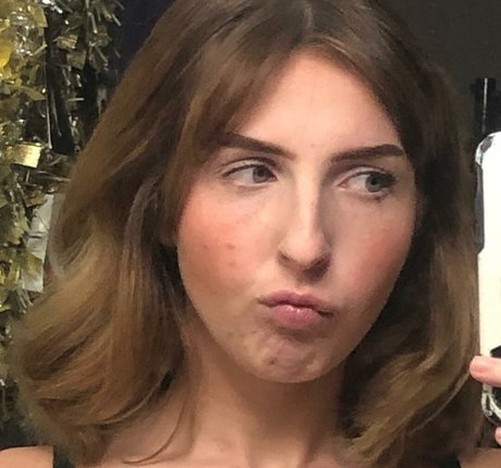 zahnspangen onlyfans nackt erotische fotos