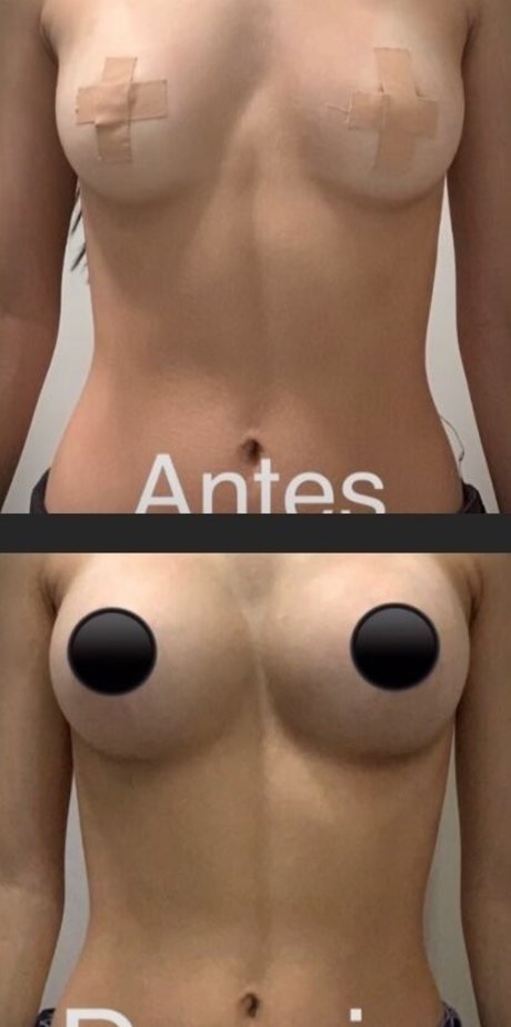 Cindy Carvalho erwachsene nackt fotos