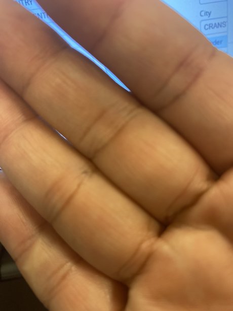 Klearly bonita estrella galería