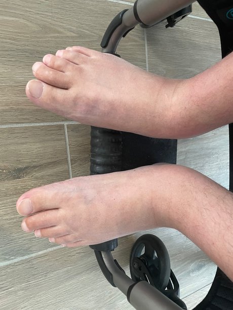 Parafeet desnudos de estrellas galerías