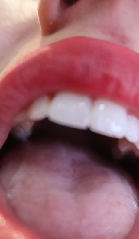 Colleen Ballinger actriz sexual galerías