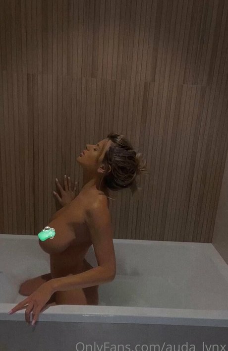 no zapret estrella atractiva galería