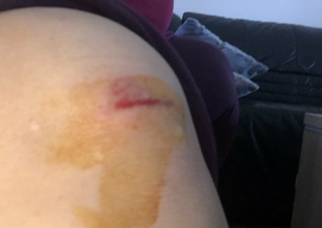 Miabigtits modelo mejor foto