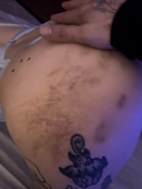 Birth defect modelo de arte imágenes