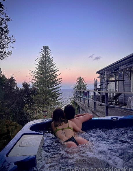 skinxskin mejor modelo galería