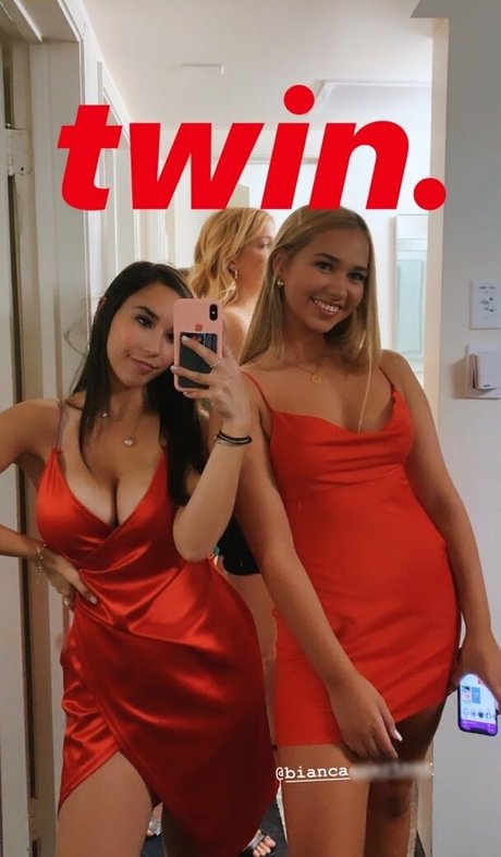 X a n t h e modelo superior imagen