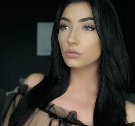 braces onlyfans xxx gallery