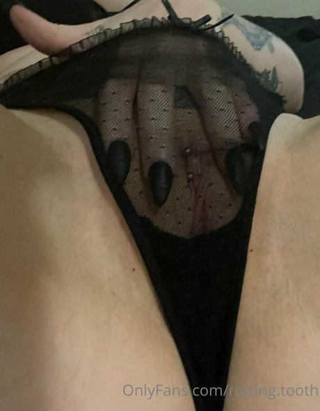 rotting tooth hot actress archive