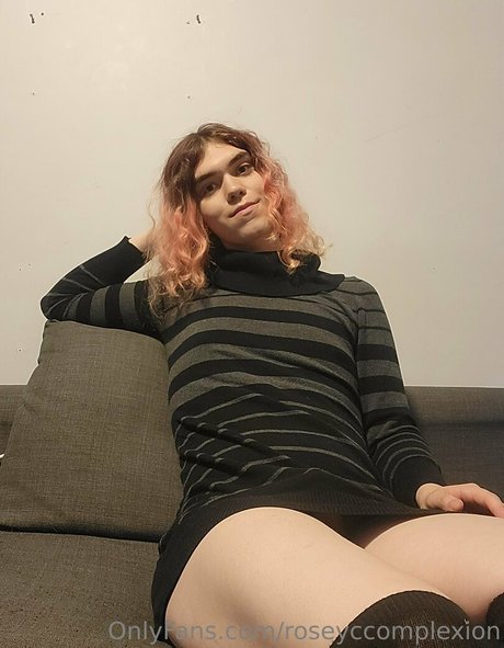 roseyccomplexion star exclusive archive