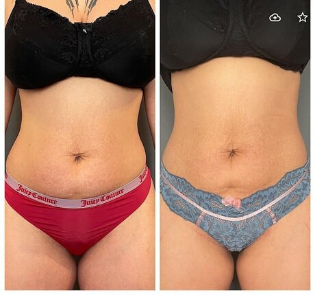 クリスマスヌードOnlyFans ポルノ 写真