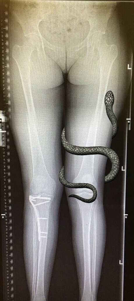 grungifungifree ヌード女優 写真