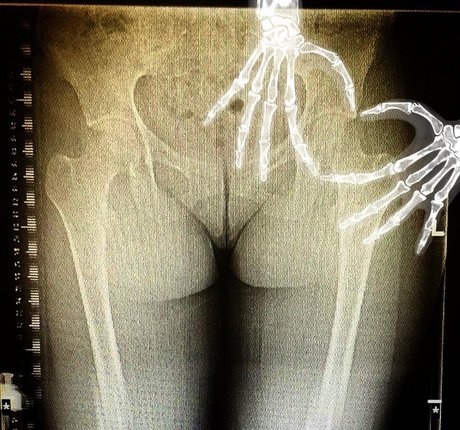 grungifungifree 素敵なモデル ギャラリー