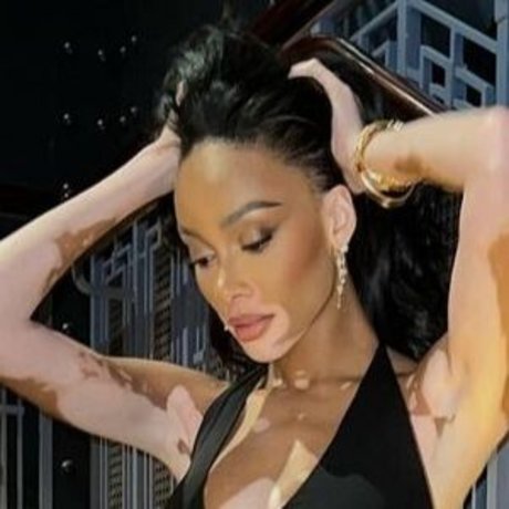 Winnie Harlow セクシー女優 写真