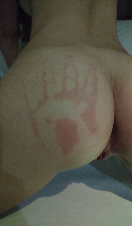 Acami HDスター 画像