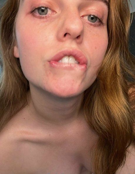 興奮した看護師OnlyFans 可愛い 画像