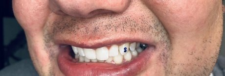 BBW フェイシャル OnlyFans ホット裸 写真