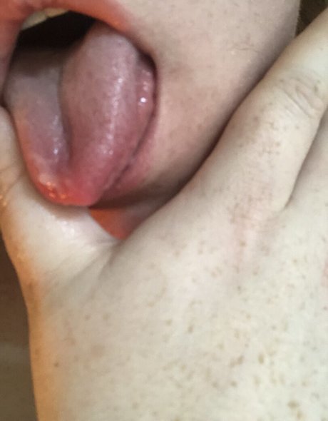 tragedyann ホットスター ギャラリー