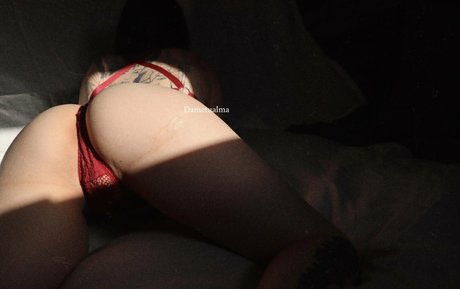 Dametualma HDスター 写真